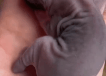 M0711020_girl found small creature bitten by an ant she adopted it_part2